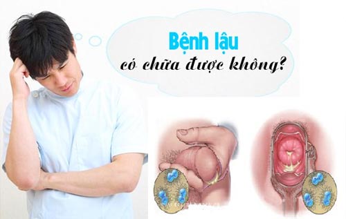 Hỗ trợ điều trị bệnh lậu ở nam giới