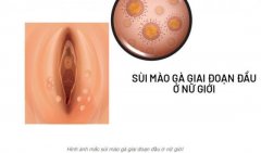 no-images