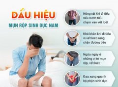 Phương pháp trị liệu mụn rộp sinh dục nam