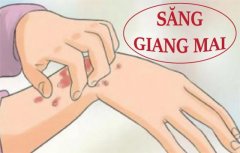 Nguyên nhân nào gây bệnh giang mai?