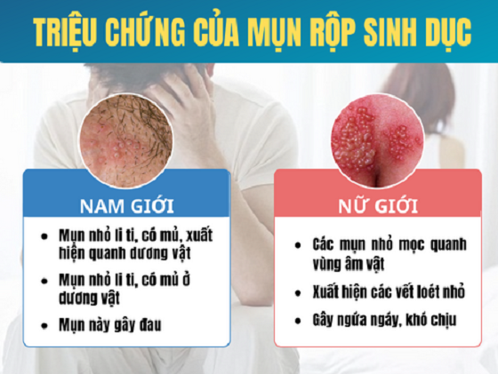 mun-rop-sinh-duc.png