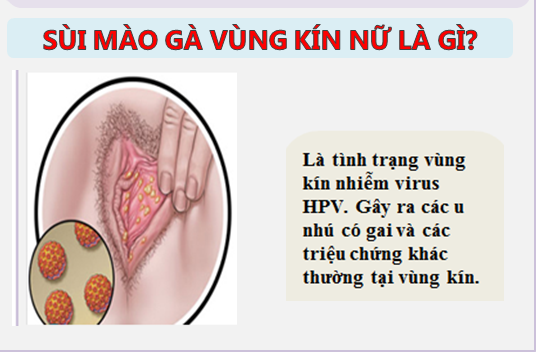 SMG VK NỮ (1).png